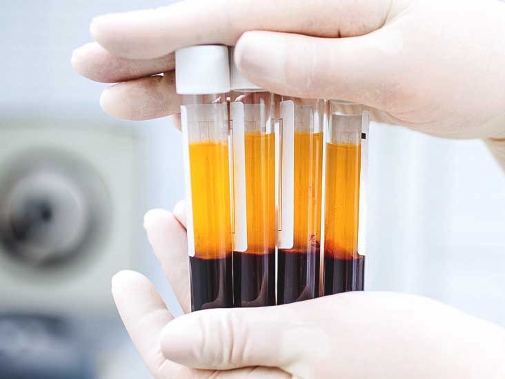 PRP and growth factor preparation